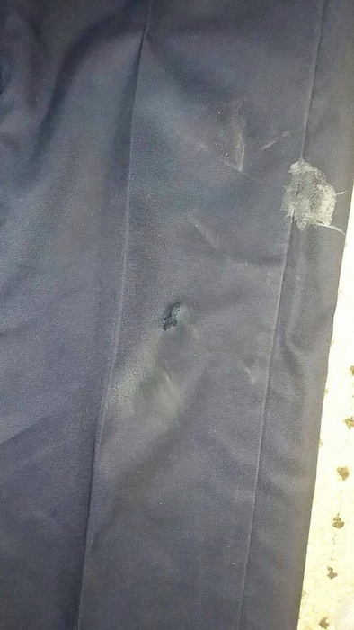 Urmele agresiune sunt vizibile și pe hainele polițistului