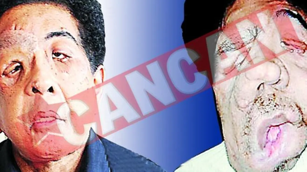 Omul-Elefant are chip nou