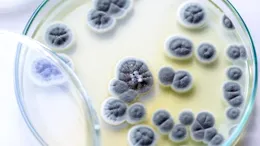 O ciupercă periculoasă, rezistentă la medicamente, se răspândește rapid în spitale. Poate provoca infecții grave