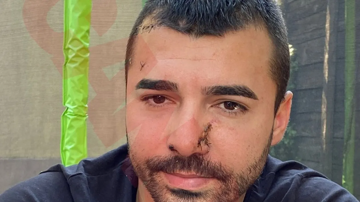 Clanul Buricea din Brăila, tentativă de asasinare! Victima își strigă disperarea în CANCAN.RO. Am fost lovit și înjunghiat. Poliția nu face nimic! + El a dat startul: omorâți-l!