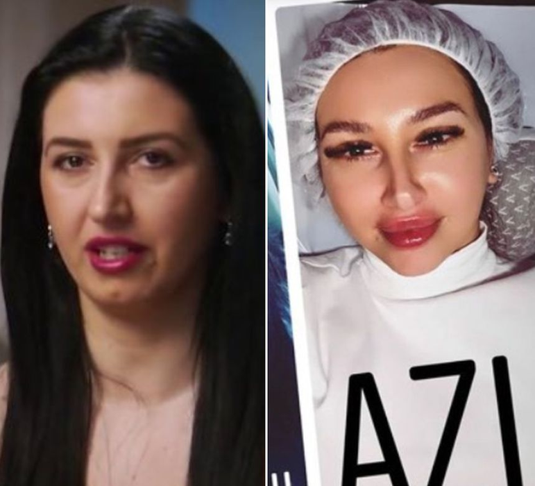 Cum arată Mirela de la Insula Iubirii după ce a devenit dependentă de operațiile estetice
