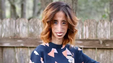 A fost catalogată “cea mai urâtă femeie din lume”, iar acum... Cum arată, în prezent, Lizzie Velasquez