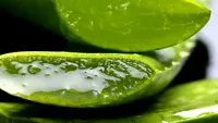 Te-a ars soarele? Aloe Vera, cel mai bun remediu împotriva arsurilor de la plajă. Iată cum se foloseşte