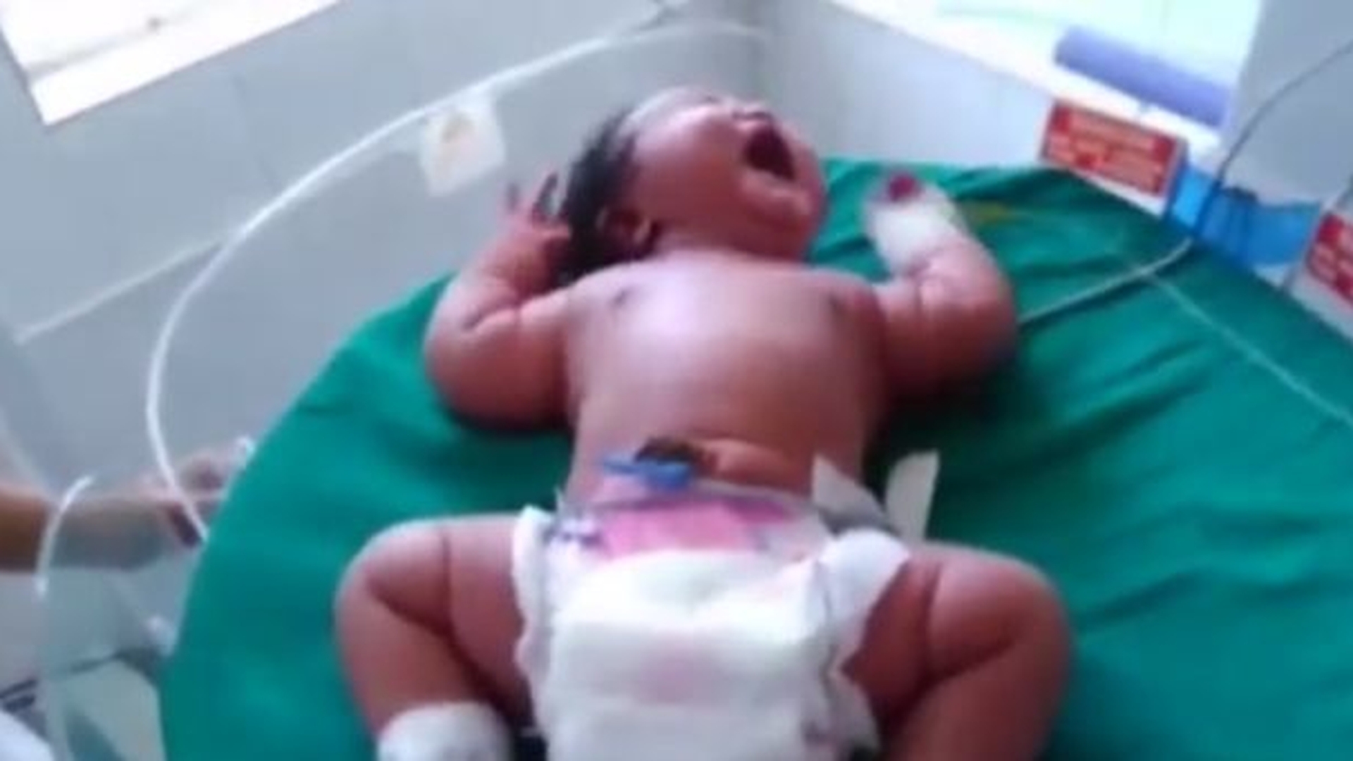 VIDEO - Cel mai MARE BEBELUŞ din lume a venit pe lume în India. Cum arată şi câte kilograme a avut la naştere 