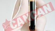 Expunerea la soare poate imbatrani prematur pielea