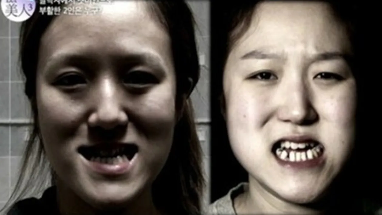 VIDEO Transformare de zile mari! Cum arată aceste gemene urâţele după ce au intrat pe mâna specialistilor. Nu le mai recunosti