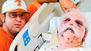 Un tractorist american a ajuns la spital cu 1.200 de intepaturi: Ciuruit de albine