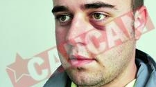 Desfigurat la Sectie