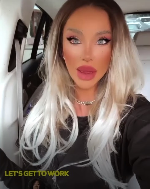 Cum arată Bianca Drăgușanu după operația de rinoplastie: ”Mă obsedează acest cheag cu sânge”