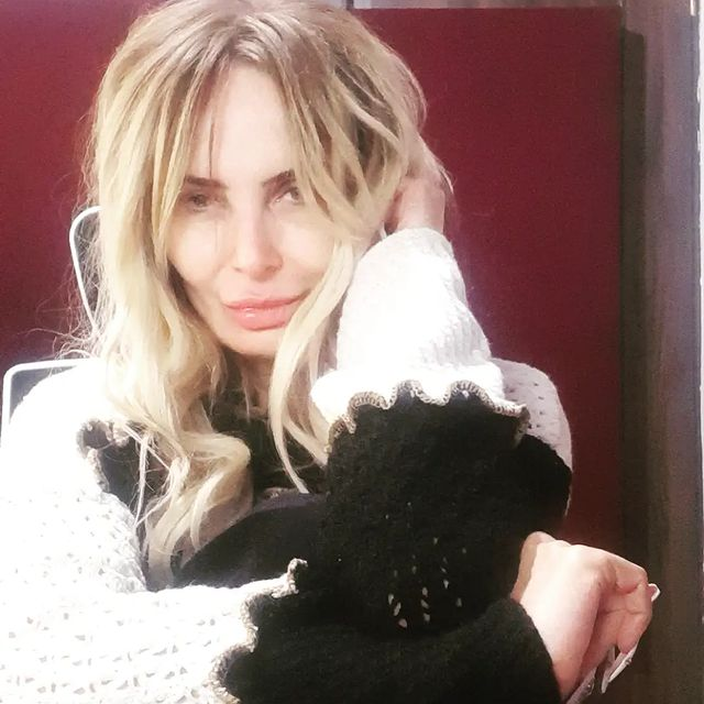 Criticată de fani pentru felul în care arată,  artista face "bilanțul" intervențiilor pe care le are!