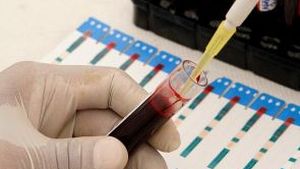 Un tânăr din Botoşani şi-a infectat intenţionat iubita cu HIV