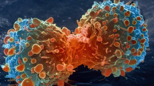 Atentie, romani! Ce se poate intampla daca bei apa de la robinet! Specialistii avertizeaza: "CANCER!"