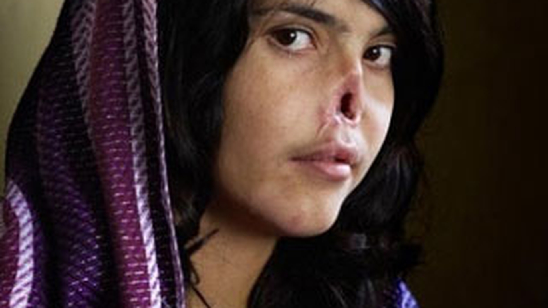 Poza cu femeia afgana fara nas si fara urechi a castigat "World Press Photo Award 2010"