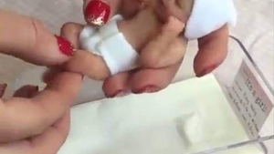 Imagini care au emoționat o lume întreagă! Cel mai mic bebeluș din lume