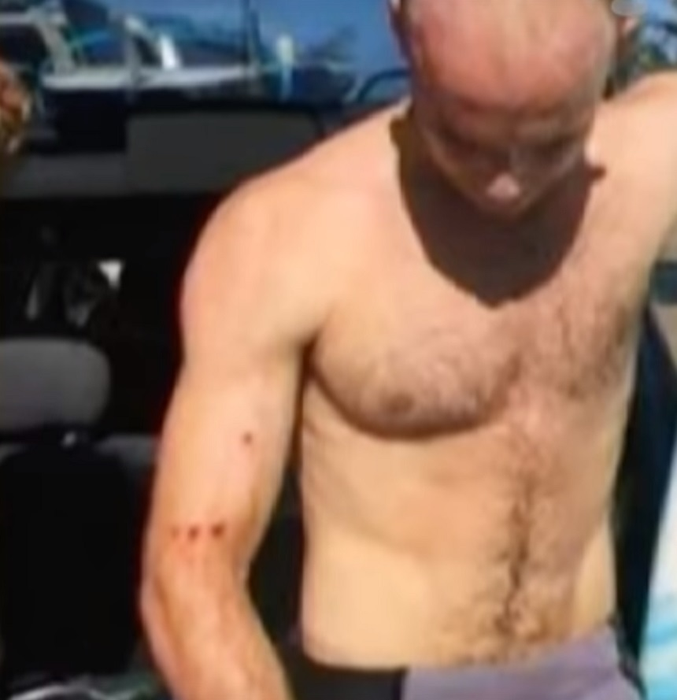 VIDEO / Un medic a bătut rechinul care a încercat să-i mănânce braţul drept: „L-am lovit cât de tare am putut şi apoi…”