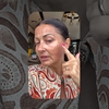 Gabriela Cristea și-a liniștit fanii după ce a apărut plină de pete pe ten. La ce procedură a apelat vedeta