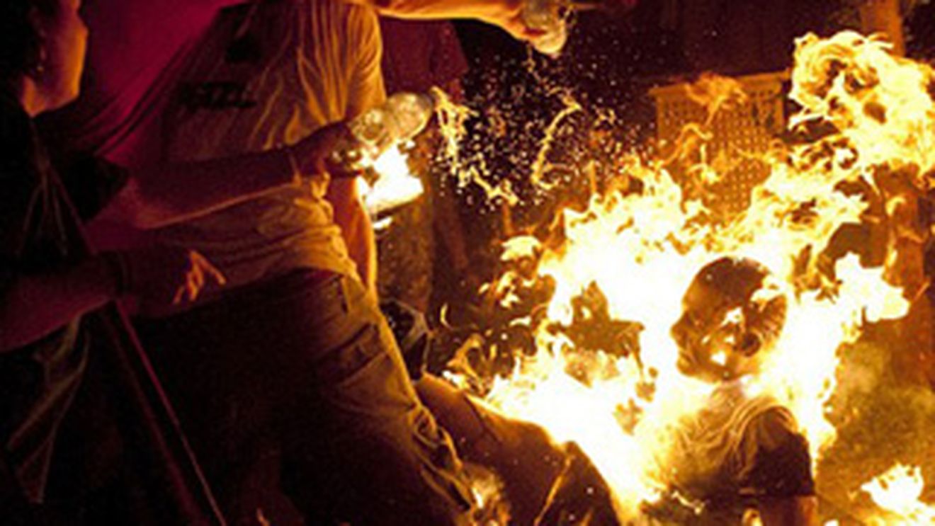 Imagini socante! Si-a dat foc, aproape a ars de viu, apoi a cerut o inghetata