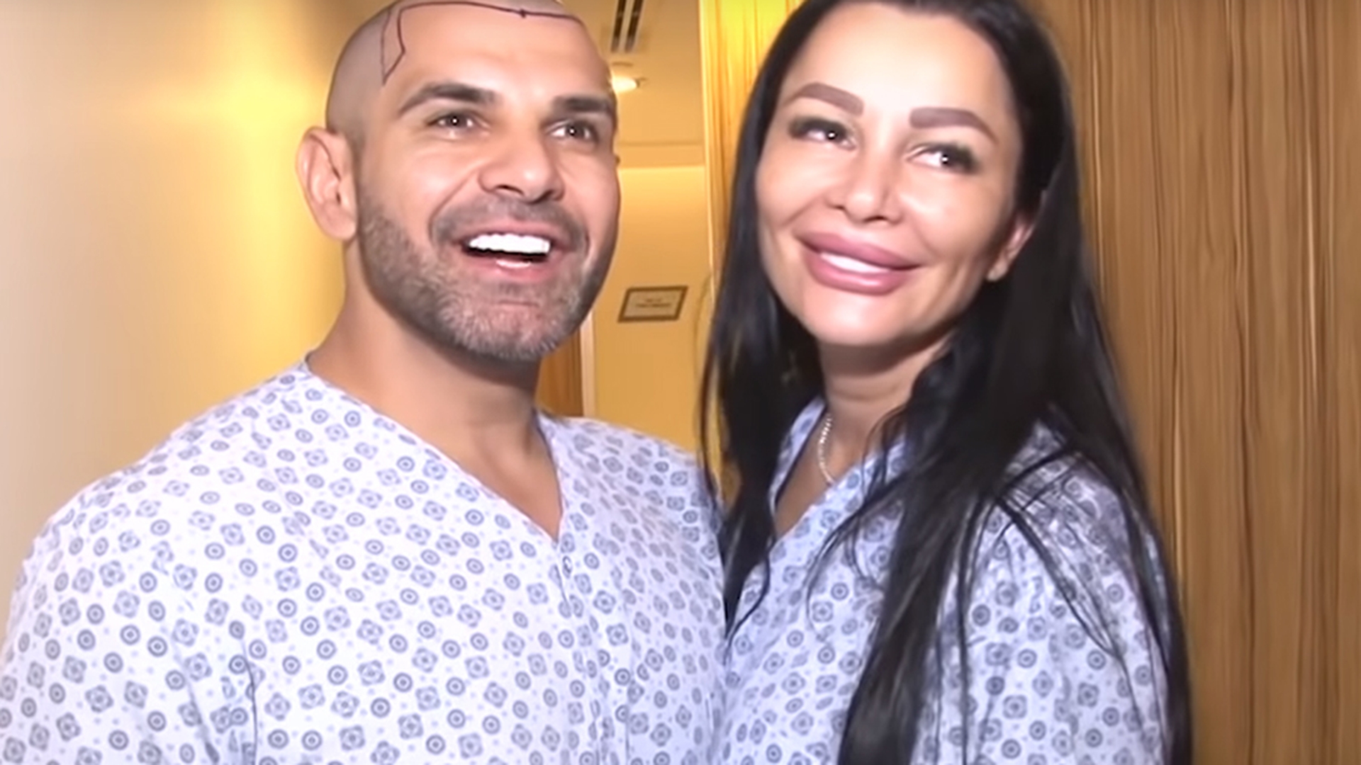 Oribil! Cum arată Florin Pastramă și Brigitte după ce și-au făcut implant de păr
