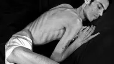 El este primul barbat care a murit de anorexie! Vezi la ce greutate ajunsese inainte de tragedie!