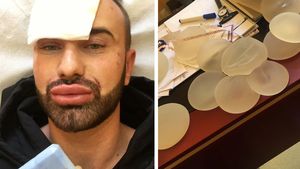 IMAGINI EXCLUSIVE! CONCHITA DE ROMÂNIA s-a decis! Şi-a operat faţa, iar acum îşi pune... SILICOANE!