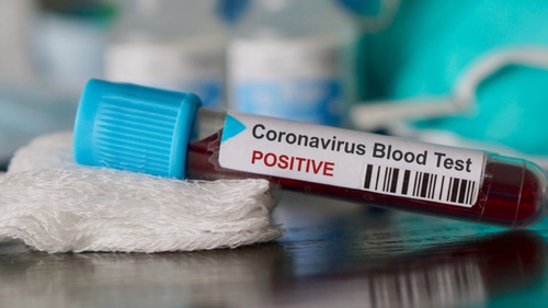 Coronavirus România. Numărul deceselor din cauza COVID-19 a ajuns la 469