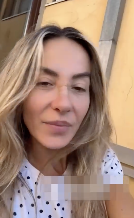 Cum arată Flavia Mihășan la 3 săptămâni de la operația la nas. Vedeta e schimbată total!