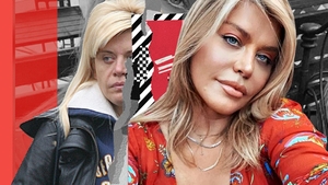 Imaginile pe care Loredana Groza le vrea șterse! Cum arăta artista înainte să fie acuzată că a trecut pe la estetician!