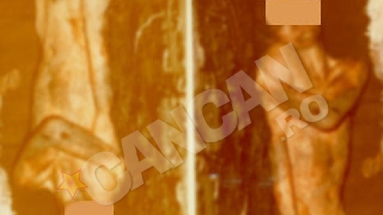 Csampar, vanatorul de oameni