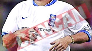 Ronaldo nu mai vede cu ochiul stang