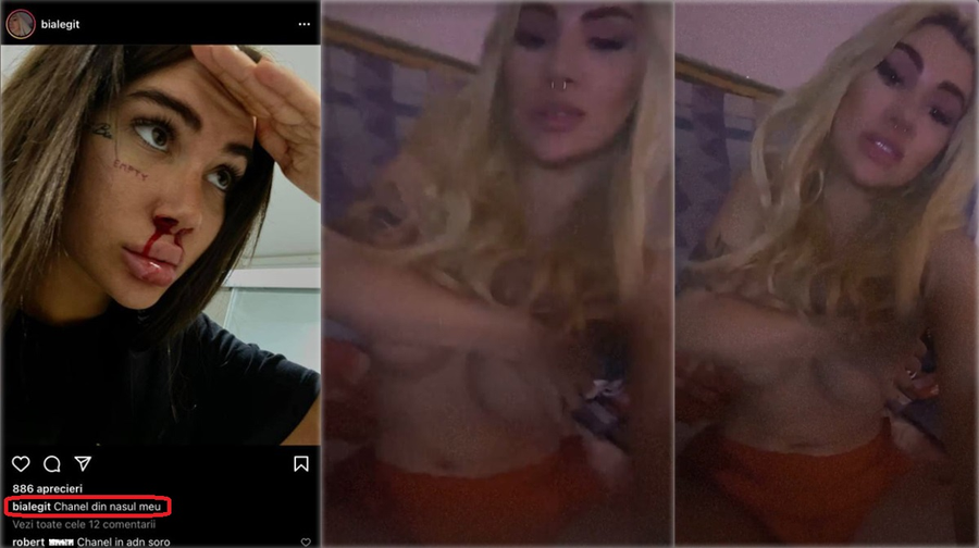 Bia Khalifa s-a pozat în timp ce îi curge sânge din nas și mulți dintre urmăritori au criticat-o, iar azi s-a filmat în timp ce era topless © Instagram & Instagram Stories