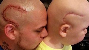 Un tată şi-a tatuat cicatricea fiului său de opt ani. Povestea care a emoţionat o lume întreagă