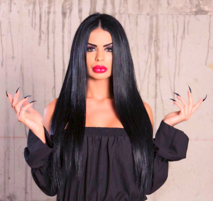 Renata se transformă pe zi ce trece! Şi-a mărit buzele! Cum arată acum