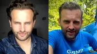Sorin Brotnei, câștigătorul Asia Express 2024, s-a închis în casă după ultima intervenție suferită: ”Nu pot ieși așa pe stradă!”
