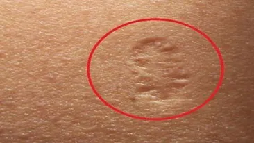 Ai si tu acest semn pe braţ? Asta este adevărata semnificaţie! Cei mai mulţi s-au căpătuit cu el înainte de ...