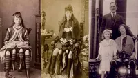 Cazul care a uimit o lume întreagă. Cine este Josephine Myrtle Corbin, femeia cu patru picioare