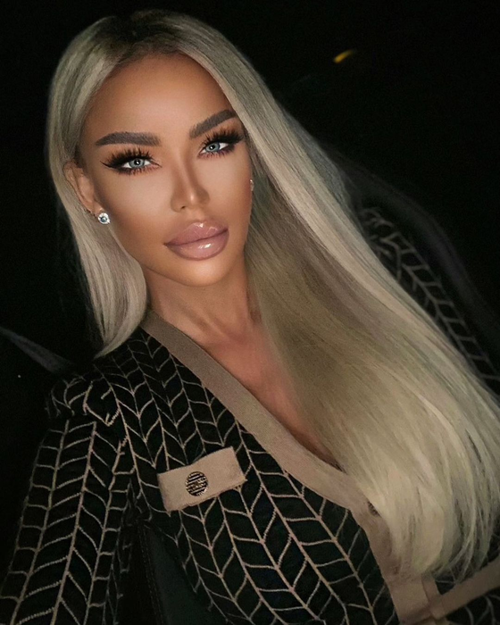 Bianca Drăgușanu, o nouă intervenţie estetică. Cum arată blondina