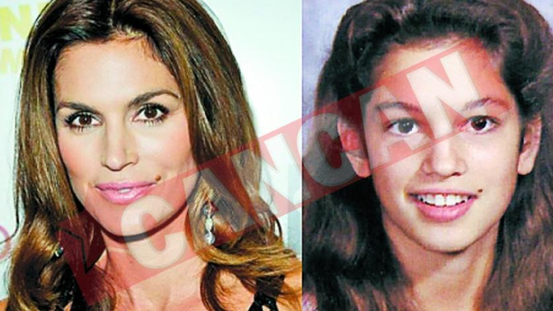Cindy Crawford renunta la alunita