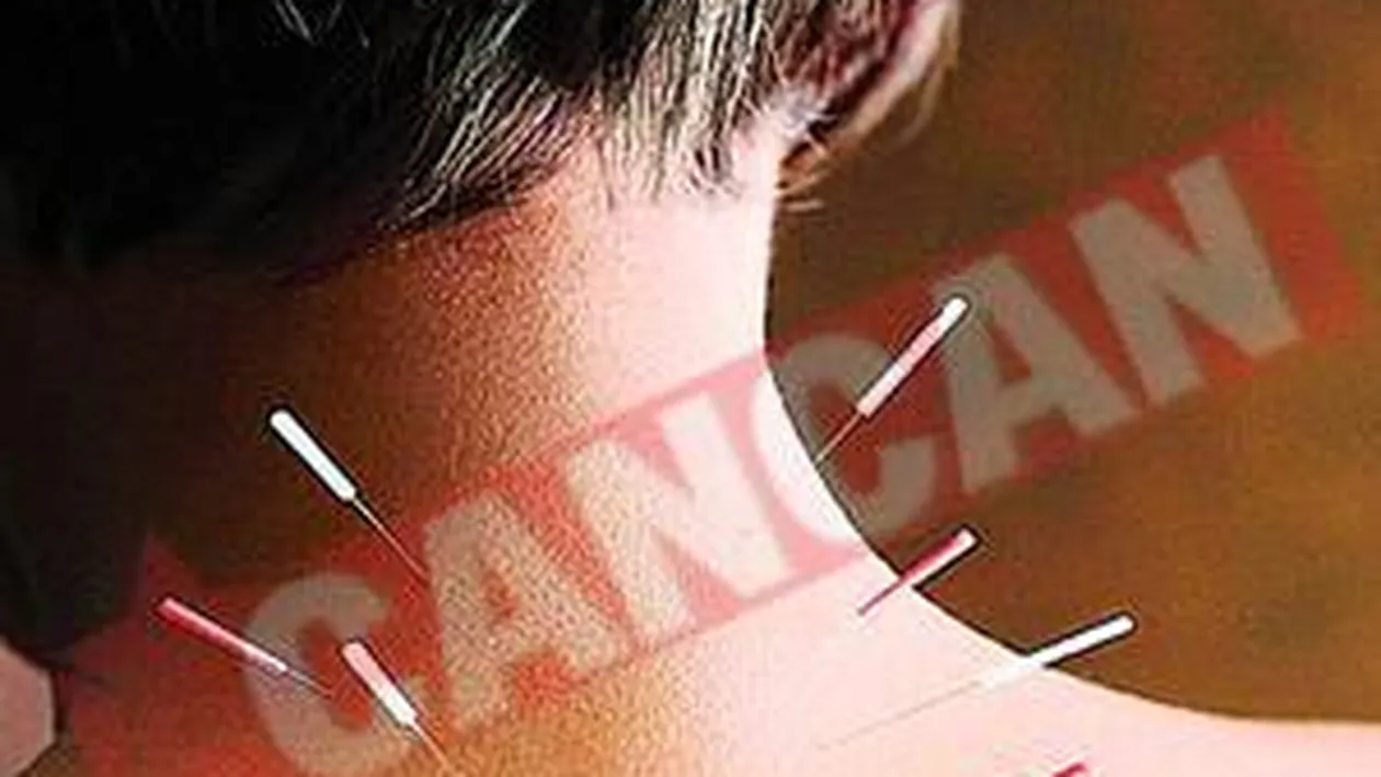 Ce boli se pot vindeca prin acupunctura