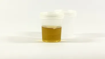 O tânără din Iaşi şi-a obligat iubitul să-i bea urina. Ce s-a întâmplat cu ea apoi