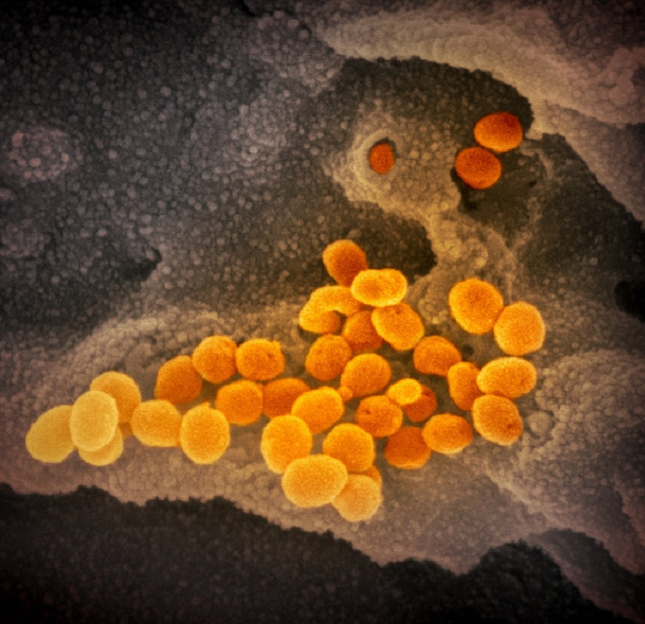 Virusul Covid-19, analizat la microscop