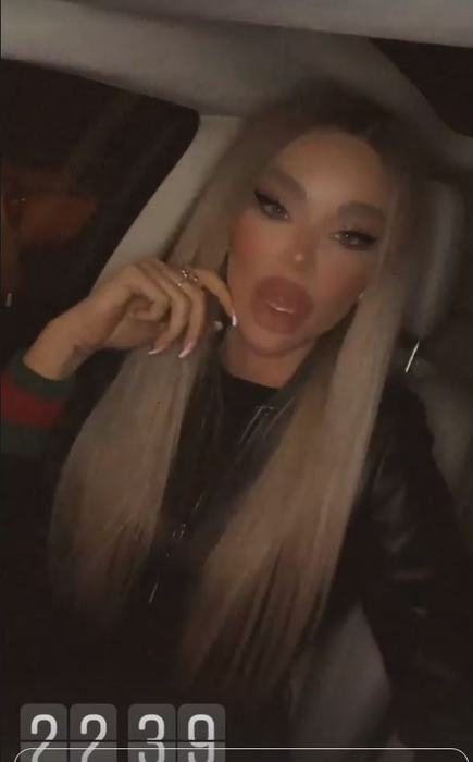 Bianca Drăgușanu a publicat mai multe imagini după ce a fost snopită de Alex Bodi: “Pentru pozele în care apar bătută, am depus o plângere penală” | FOTO
