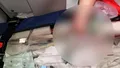 Caz IREAL în Maternitatea Botoșani! O graviduță de 19 ani a născut un bebeluș microsom