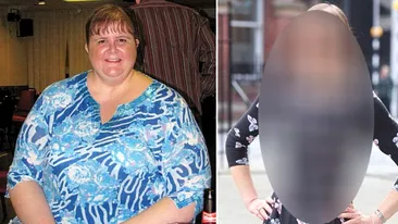 Transformarea INCREDIBILA a unei femei care a slabit 83 de kg intr-un an: Nu mai suportam sa ma uit in oglinda Vezi cum arata