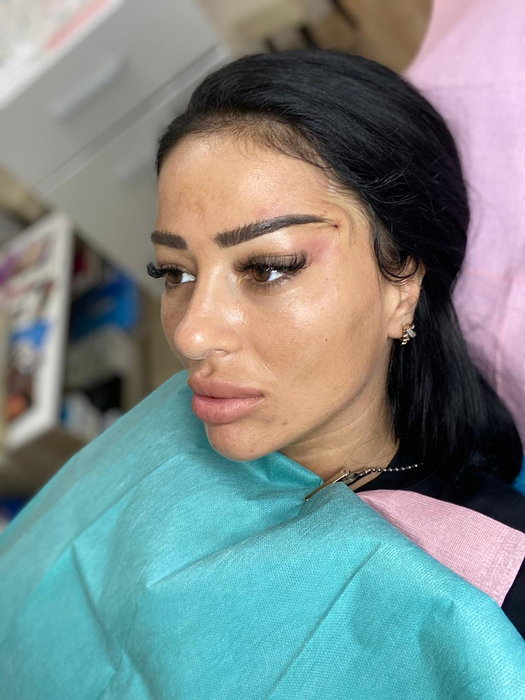 Simona Florentina, la câteva zile după intervenția chirurgicală