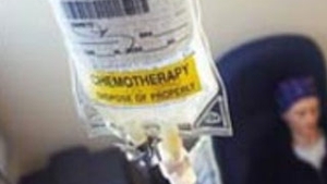 15 februarie, Ziua Internationala a Copilului bolnav de cancer