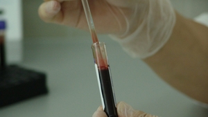 Poți dona plasmă după ce te-ai vaccinat împotriva Covid-19? Ministerul Sănătății face anunțul 
