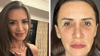 Mara Bănică, mesaj dur pentru cei care au criticat-o că și-a făcut lifting facial: ”Era mai bine să fi spus că m-am apucat de yoga?!”
