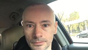 MIHAI ALBU, probleme în urma implantului de păr? Designerul a mărturisit:,,E "buba" PE cap’’