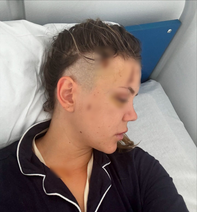 Emily Burghelea a publicat noi imagini tulburătoare/ Sursa foto: Instagram