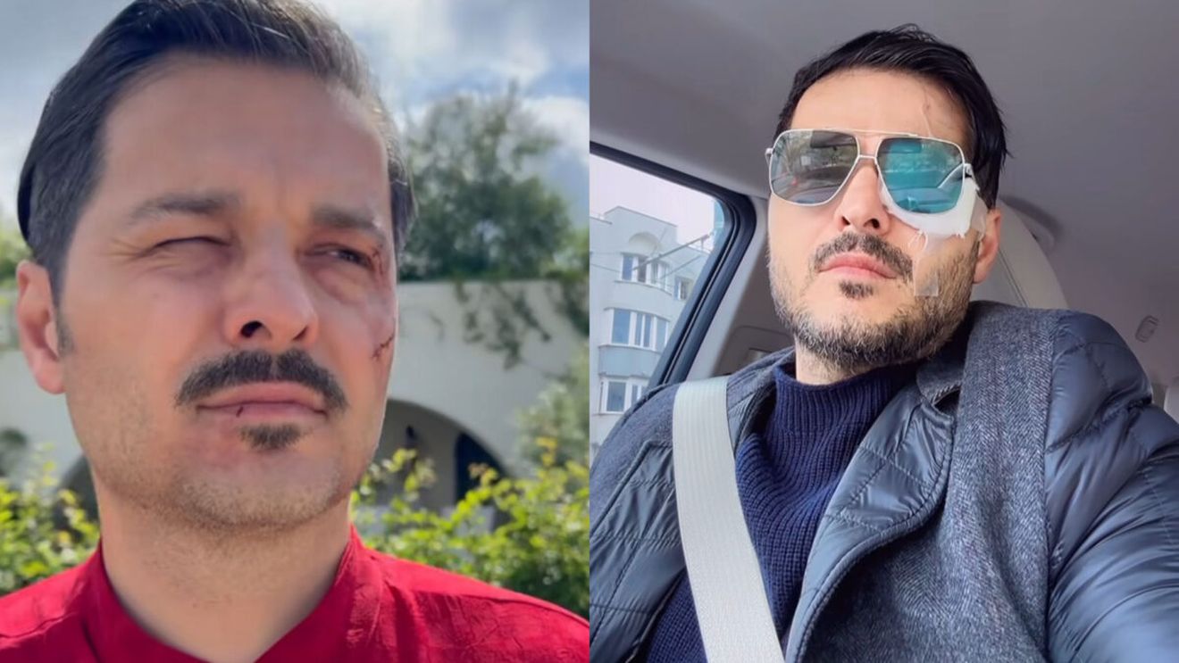 Liviu Vârciu, de urgență la spital după ce a suferit un accident: ”M-a ferit Dumnezeu, că puteam să fiu...”